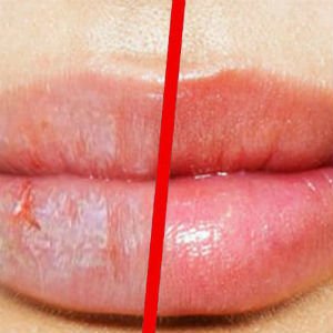Cómo evitar los labios secos y cortados